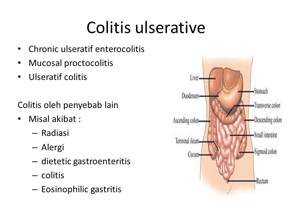 Que se puede comer cuando tienes gastroenteritis